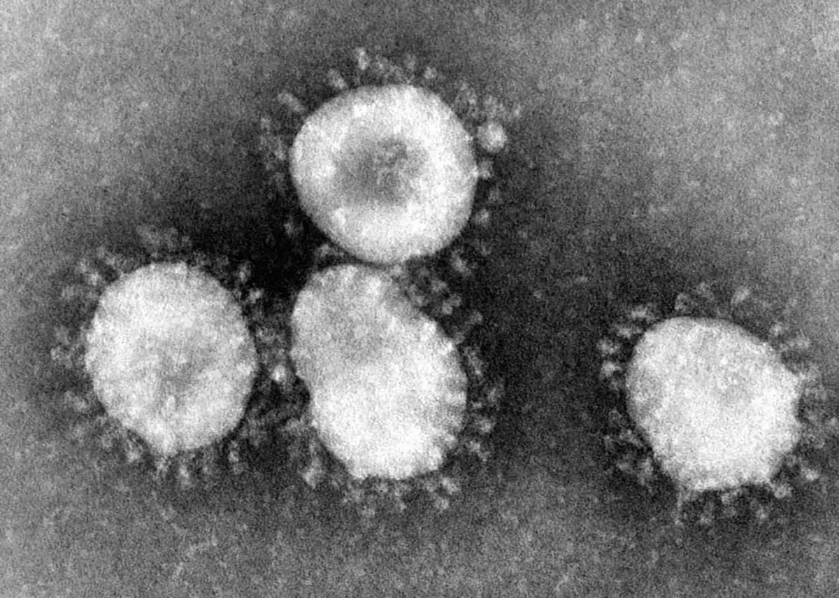 Coronavirus SOS Alert
